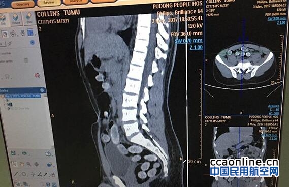 qq%e6%88%aa%e5%9b%be20170619160949